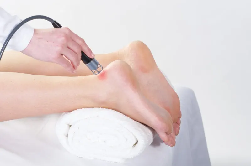 Terapia con Láser